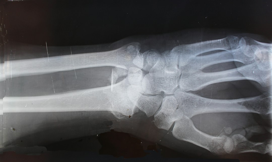 How To Proceed if You’re Injured at the Workplace 2 img